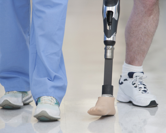 DRDL, AIIMS Unveil India’s First Carbon Fibre Foot Prosthesis