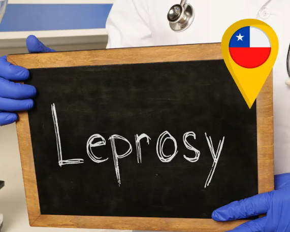 Chile Eliminates Leprosy: Verified by WHO